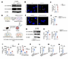 SHP2 LLPS promotes complex I and III hyperactivation.