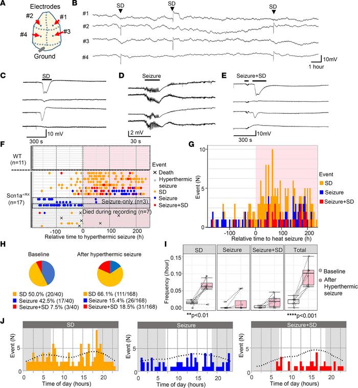 Seizure and SD phenotype of Scn1a+/RX mice before and after a hypertherm...
