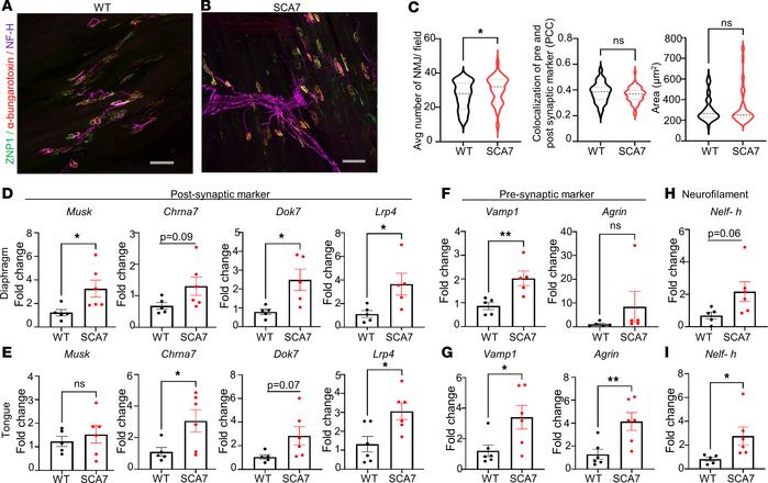 Increase in neuromuscular junction (NMJ) clusters and higher expression ...