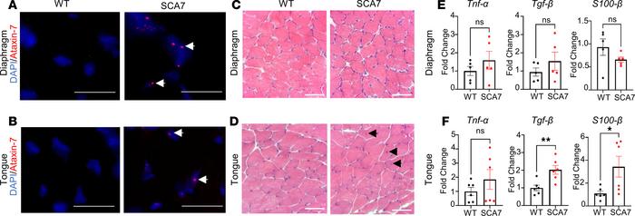 Intranuclear accumulation of ataxin-7 in diaphragm and tongue.
(A and B)...