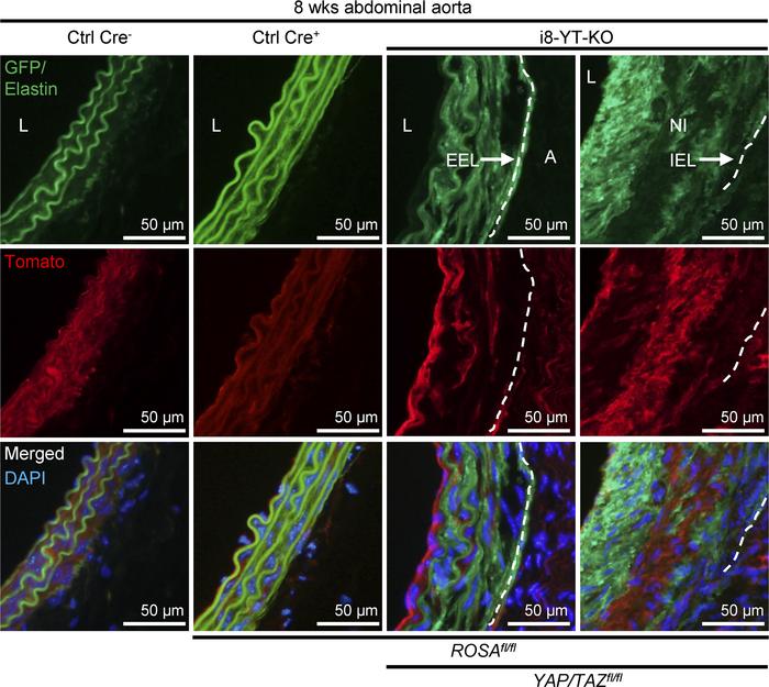 Lineage tracing in i8-YT-KO mice shows that SMCs contribute the bulk of ...