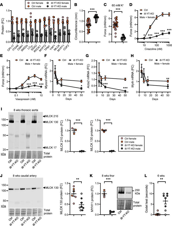 Loss of SMC differentiation and arterial contractility in i8-YT-KO mice ...