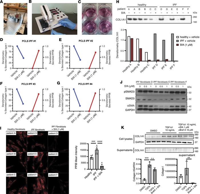 SfA reduces collagen secretion from primary fibrotic fibroblasts.
(A and...