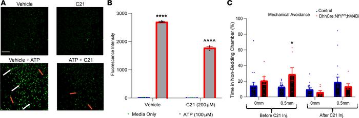 Chemogenetic inhibition of SCs suppresses mechanical hypersensitivity in...