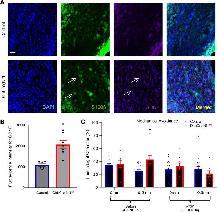 GDNF is elevated in the DRG of DhhCre Nf1fl/fl when compared with contro...