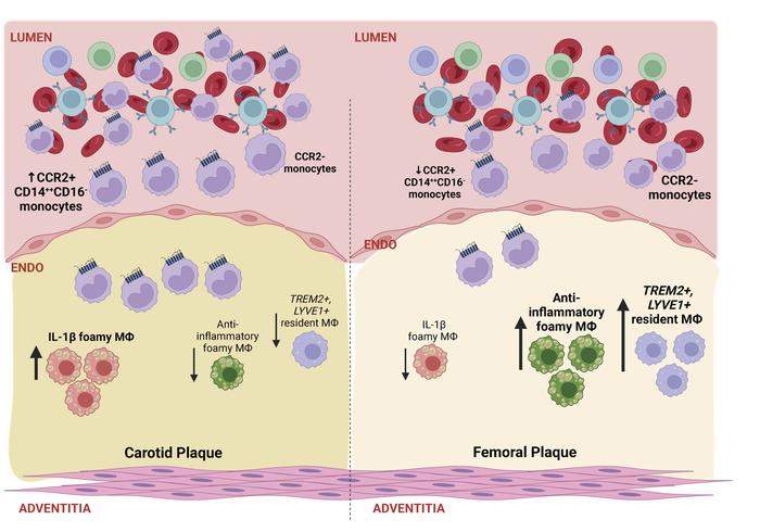 JCI Insight - Single-cell profiling reveals comparatively inflammatory ...