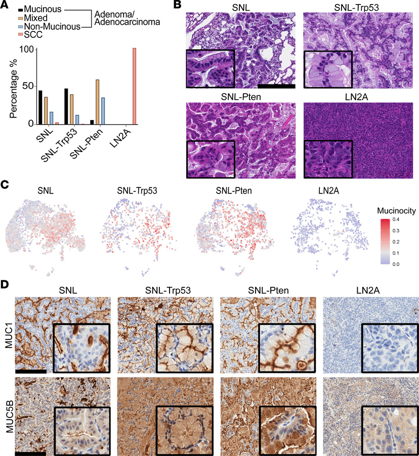 Pten loss alters LUAD mucin composition and affects lipid pathways in th...