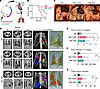sgRNA-mediated CRISPR knockout of Trp53 and Pten in vivo leads to increased