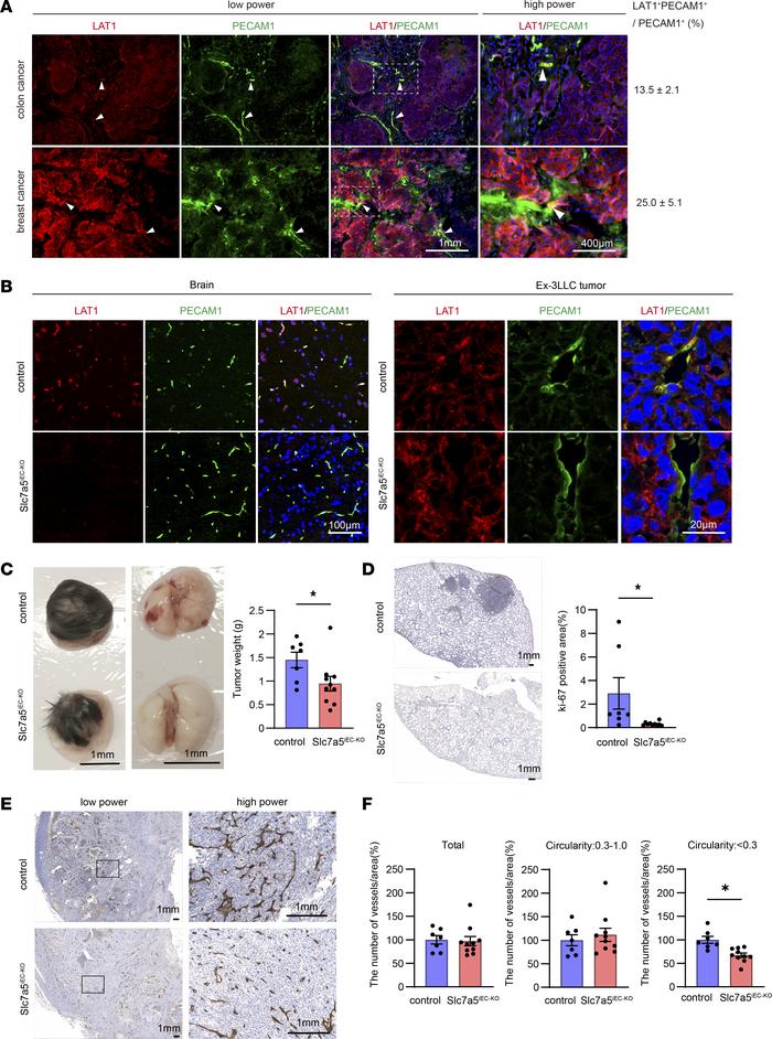 Endothelial cell–specific LAT1 ablation decreased transplanted tumor gro...