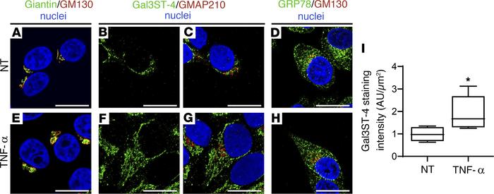 Altered Gal3ST-4 localization in TNF-α–stimulated HSG cells.
Representat...