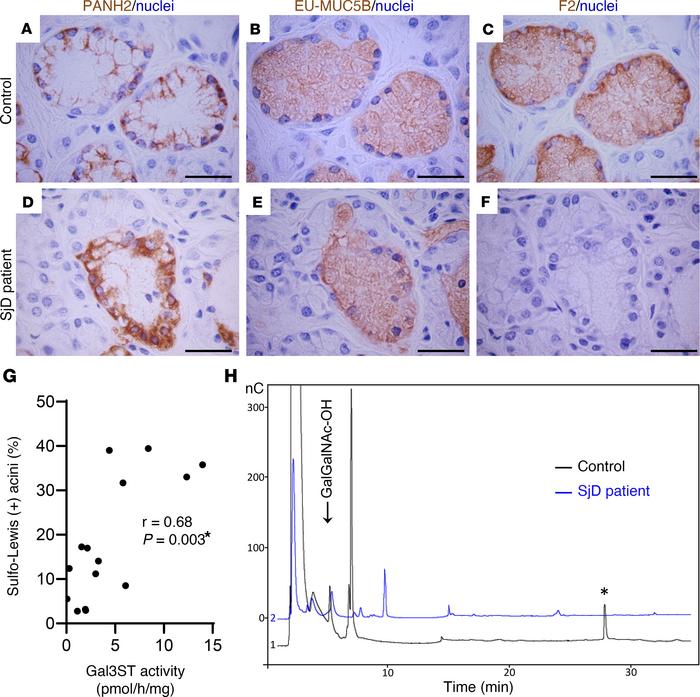 Decreased MUC5B sulfated O-glycans in LSGs from patients with SjD.
(A–F)...