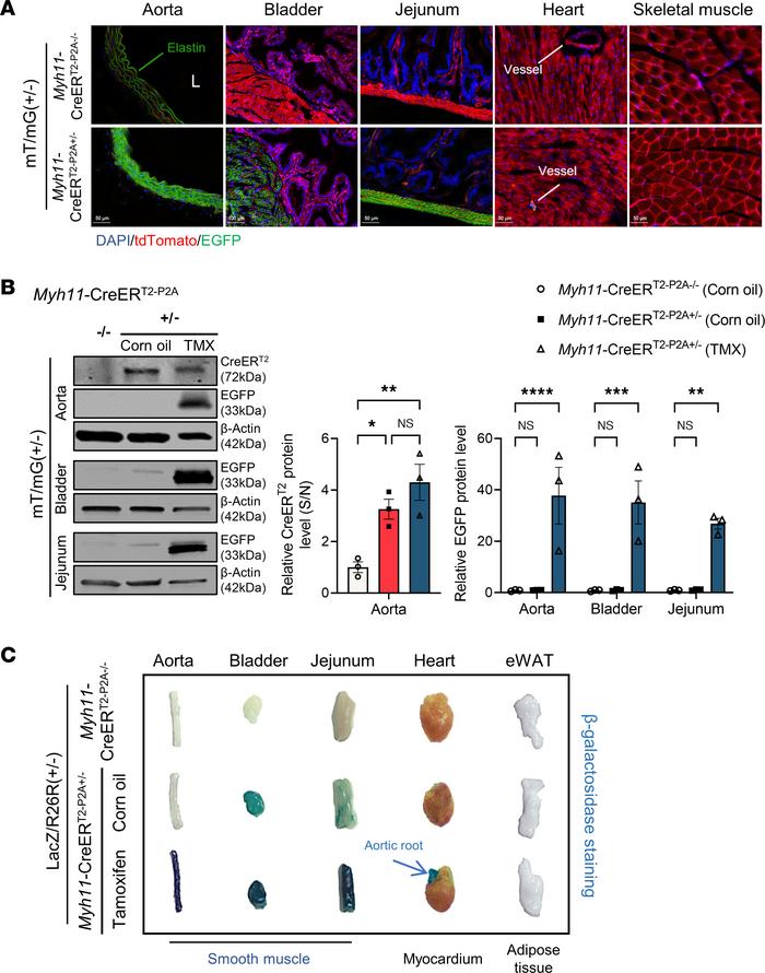 Characterization of tamoxifen-inducible Cre activity in Myh11-CreERT2–P2...