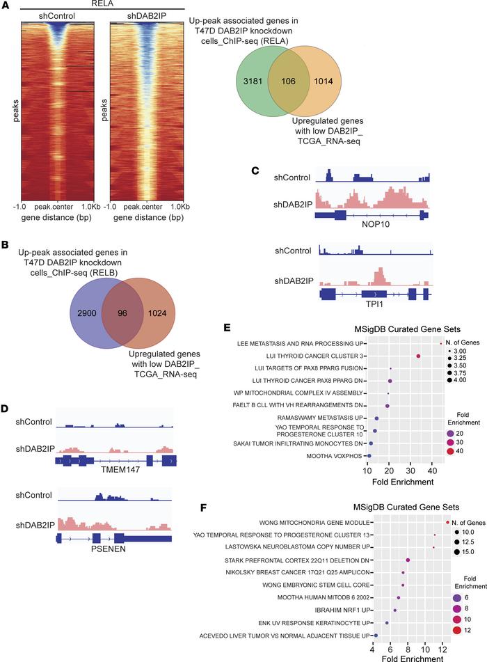 The effect of low DAB2IP on the genomic binding of
NF-κB subunits. (A) P...
