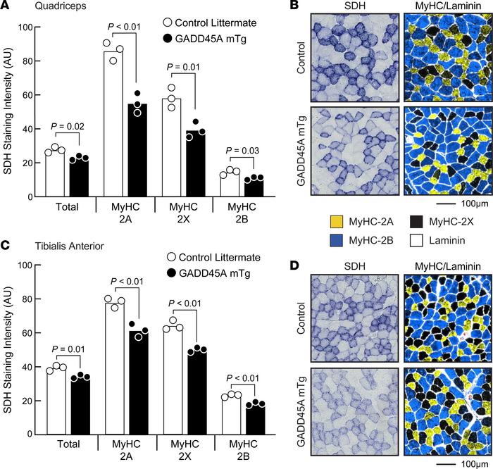 GADD45A reduces oxidative capacity in glycolytic and oxidative skeletal ...