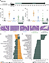 SIK2/SIK3 inhibition attenuates disease in T cell transfer colitis model.