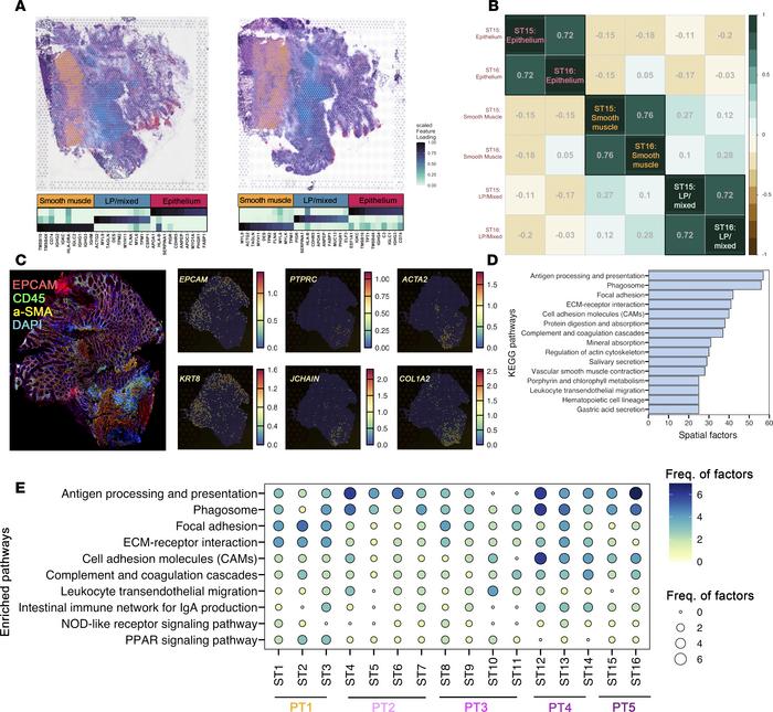 Non-negative matrix factorization delineates compartmentalization and re...