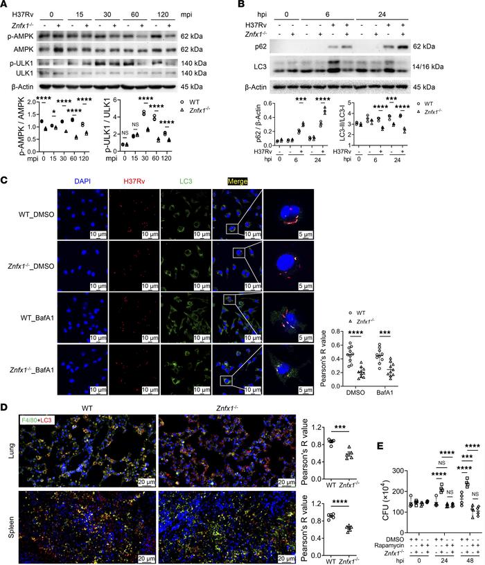 ZNFX1 regulation of macrophage bactericidal activity through the autopha...