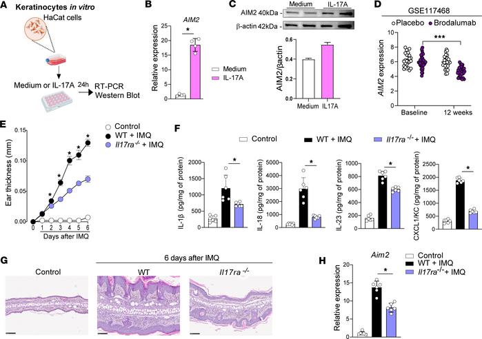 IL-17A regulates AIM2 expression in psoriasis-like disease models.
(A) S...