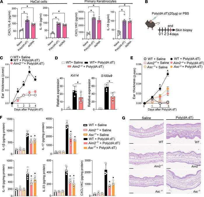 Intradermal injection of AIM2 ligand induces psoriasis-like inflammation...