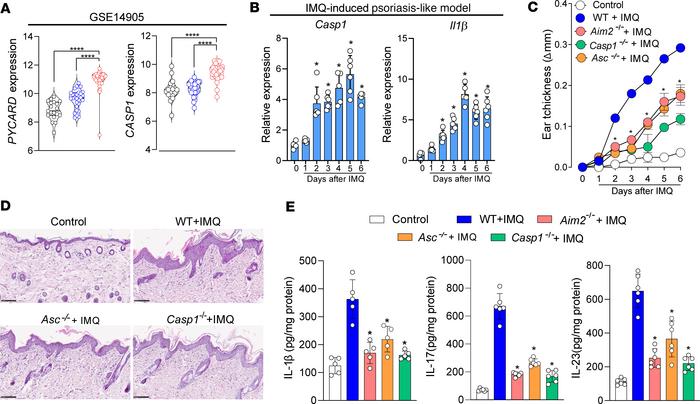 ASC and caspase-1 are required for the development of IMQ-induced psoria...
