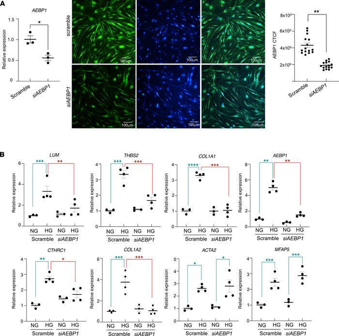 Molecular changes in human retinal pericytes (HRP) cultured in high-gluc...
