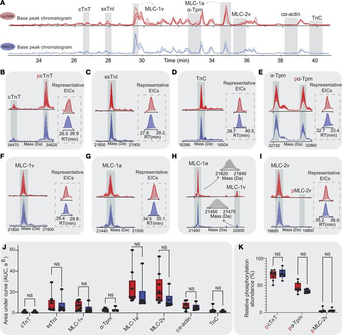 Top-down proteomics of the hiPSC-ECT cardiac sarcomere.
(A) Selected bas...