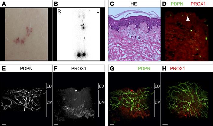 Macroscopic as well as 2D and 3D microscopic manifestations of a patient...