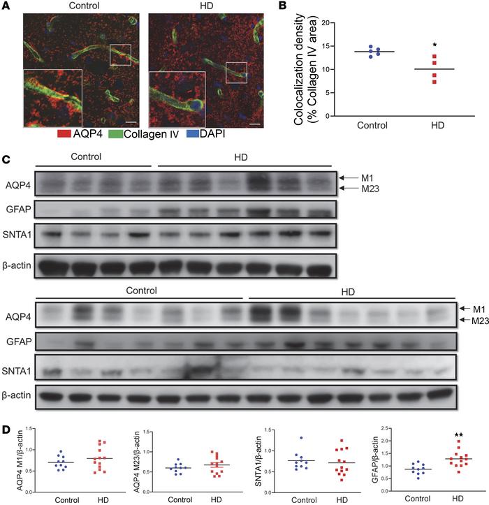 Reduced perivascular AQP4 localization accompanying astrogliosis in the ...