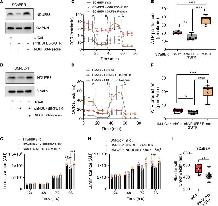 Complex I–mediated (NDUFB8-mediated) OXPHOS activity, and tumor growth i...