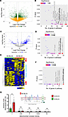 Identification of complex I–mediated OXPHOS activity in AA BLCA.
