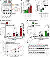 Pharmacological perturbation of complex I inhibition in AA BLCA.