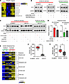 Genetic perturbations of NDUFB8 affects GLS1 and glutamine-mediated mitocho