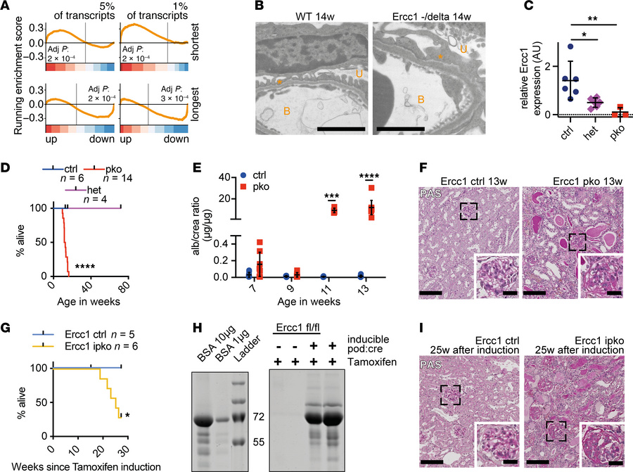 Podocyte-specific Ercc1 deletion causes glomerulosclerosis.
(A) Gene set...