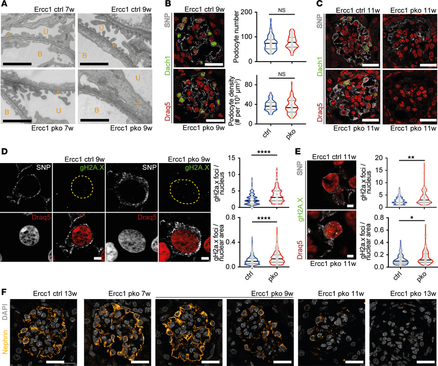 The podocyte-specific constitutive knockout of Ercc1 leads to foot proce...