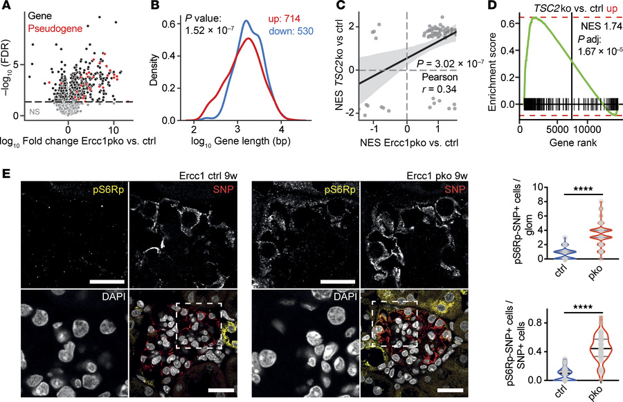 DNA damage accumulation in podocytes leads to a shift toward smaller tra...