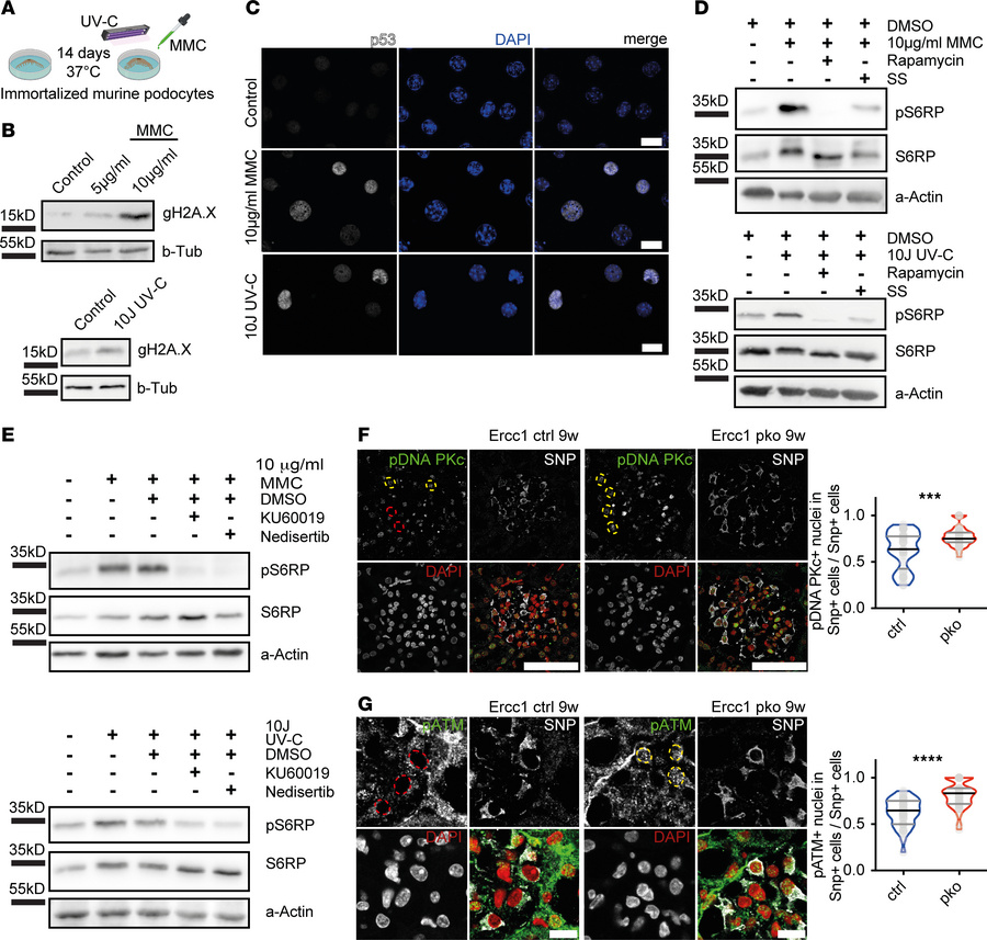 mTORC1 activation in podocytes upon genomic stress is mediated through D...