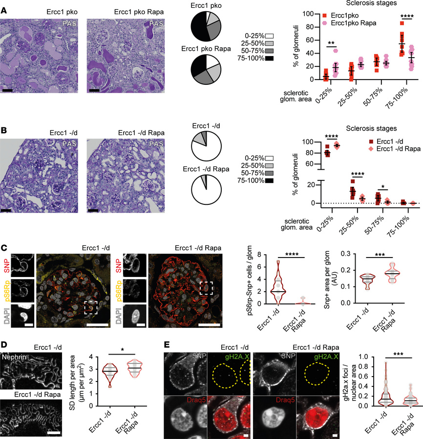 mTORC1 inhibition upon genomic stress can modulate podocyte damage and d...
