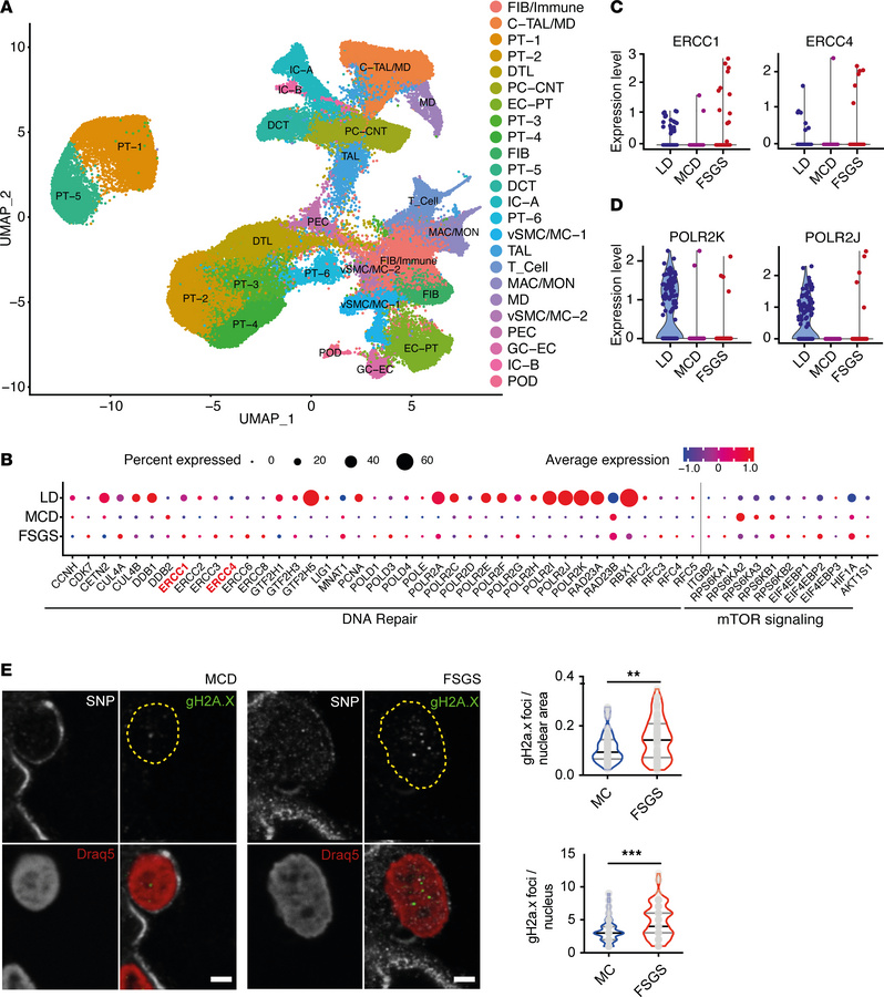 Podocytes accumulate DNA damage during human FSGS.
(A) Uniform manifold ...