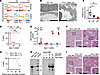 Podocyte-specific Ercc1 deletion causes glomerulosclerosis.