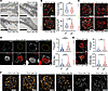 The podocyte-specific constitutive knockout of Ercc1 leads to foot process