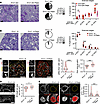 mTORC1 inhibition upon genomic stress can modulate podocyte damage and decr
