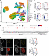 Podocytes accumulate DNA damage during human FSGS.