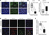 Notch signaling is activated in lesional skin of patients with PN.