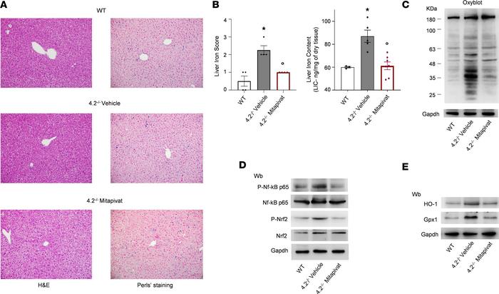 Mitapivat-treated 4.2–/– mice had reduced liver iron accumulation and pr...