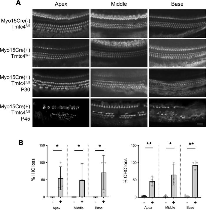 Hair cell loss in Myo15Cre/Tmtc4-cKO mice.
(A) Whole-mount IHC against M...