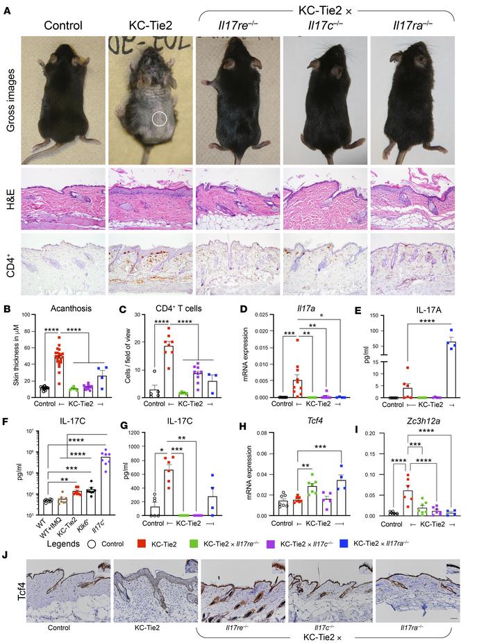 KC-Tie2 mice have significant increases in skin IL-17C.
Skin inflammatio...