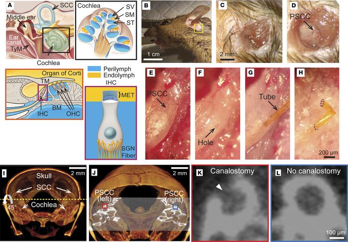 Surgical approach for PSCC injection into the cochlea.
The zoomed-in ima...
