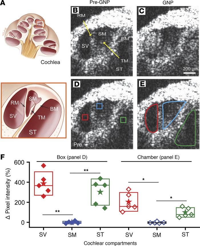 In vivo real-time monitoring of gold nanoparticles (GNPs) injected throu...