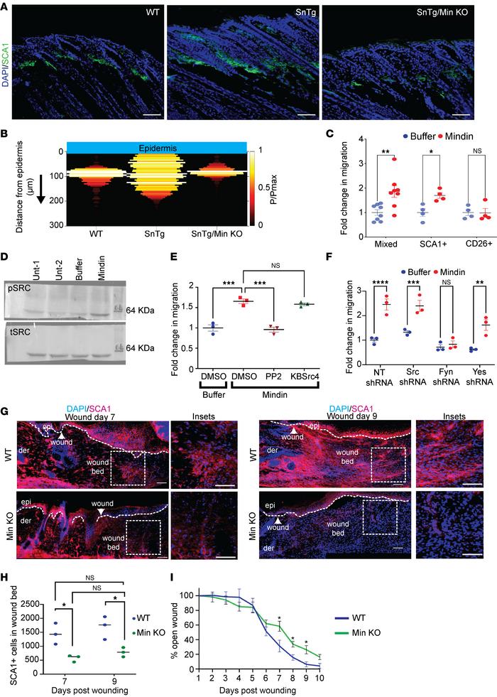 Mindin induces migration of SCA1+ fibroblasts via Fyn kinase.
(A) IF sta...