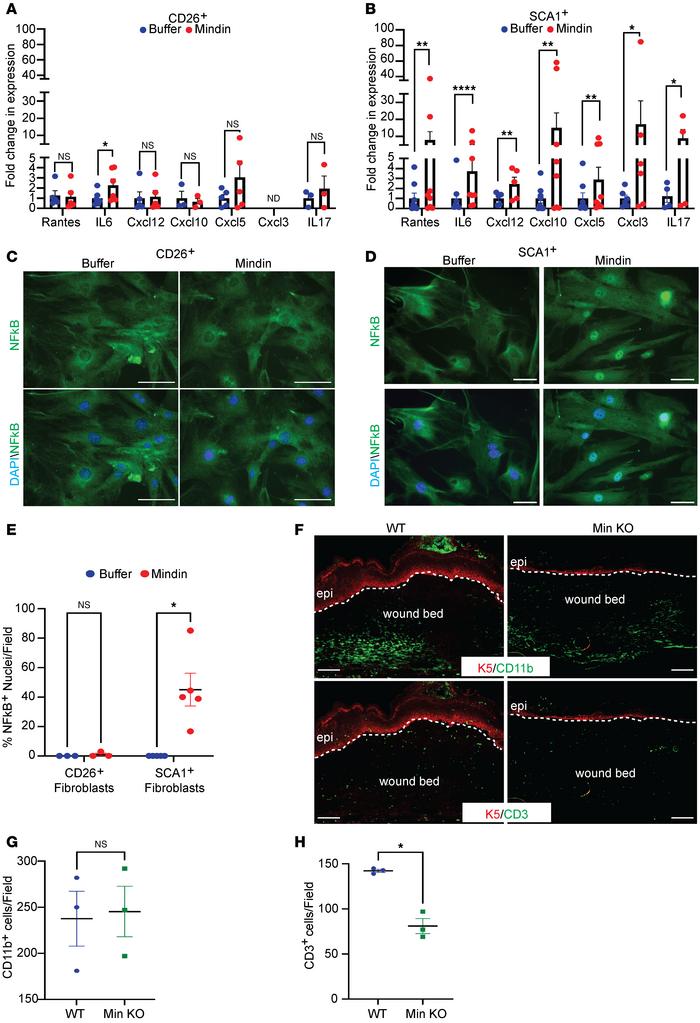 Mindin stimulates inflammatory cytokine production in SCA1+ fibroblasts....
